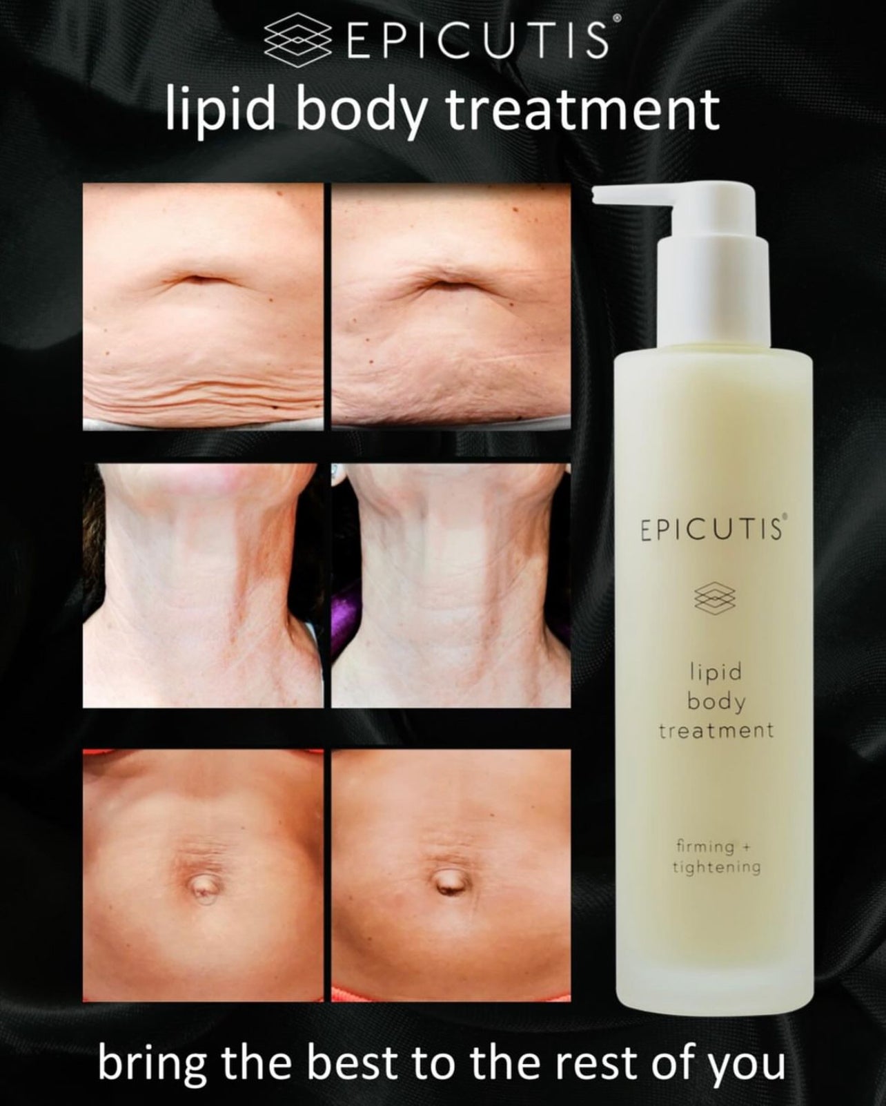 Lipid Body Treatment